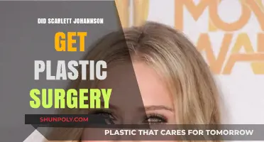 Scarlett Johansson's Transformation: Plastic Surgery Rumors Explored