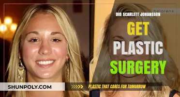 Scarlett Johansson's Transformation: Plastic Surgery Rumors Explored