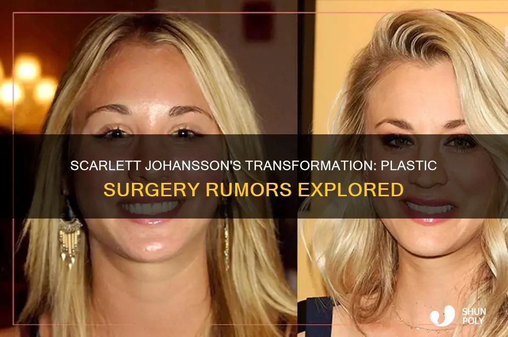 did scarlett johansson get plastic surgery