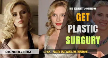Scarlett Johansson's Transformation: Plastic Surgery Rumors Explored