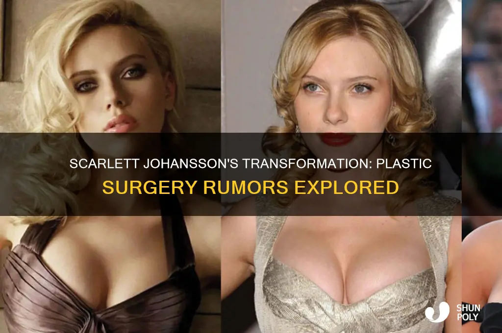 did scarlett johansson get plastic surgury