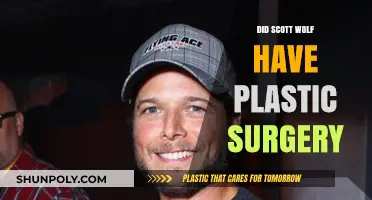 Scott Wolf Plastic Surgery: Fact-Checking the Rumors and Speculations
