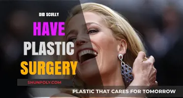 Did Scully Undergo Plastic Surgery? Unveiling the Truth Behind the Rumors