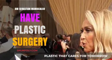 Sebastian Maniscalco Plastic Surgery: Fact-Checking the Rumors and Speculation