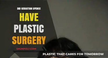 Sebastian Spence Plastic Surgery: Fact or Fiction? Uncovering the Truth