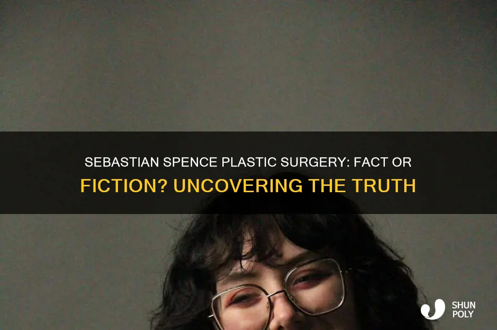 did sebastian spence have plastic surgery