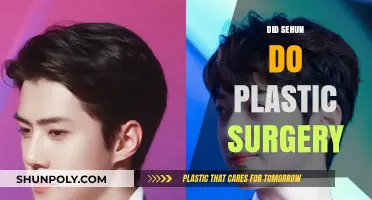 Sehun's Transformation: Plastic Surgery Rumors and the Truth Behind Them