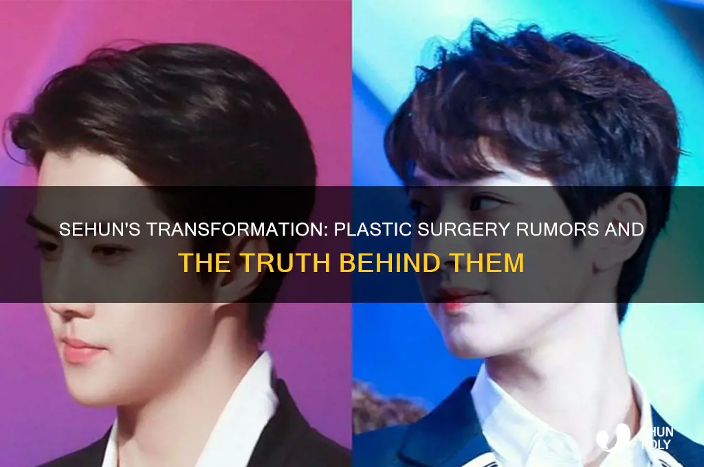 did sehun do plastic surgery