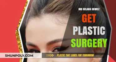 Selena Gomez Plastic Surgery Rumors: Fact or Fiction?