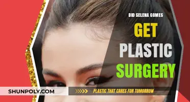 Selena Gomez Plastic Surgery Rumors: Fact or Fiction?