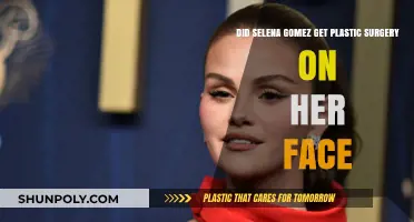 Selena Gomez's Facial Transformation: Plastic Surgery Speculations Explored