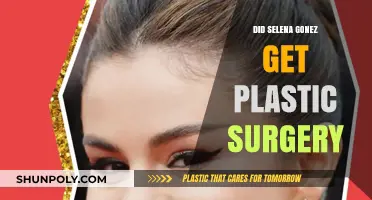 Selena Gomez Plastic Surgery Rumors: Fact or Fiction?