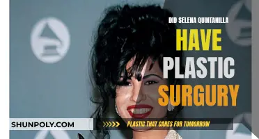 Selena Quintanilla's Plastic Surgery: What Procedures Did She Get?