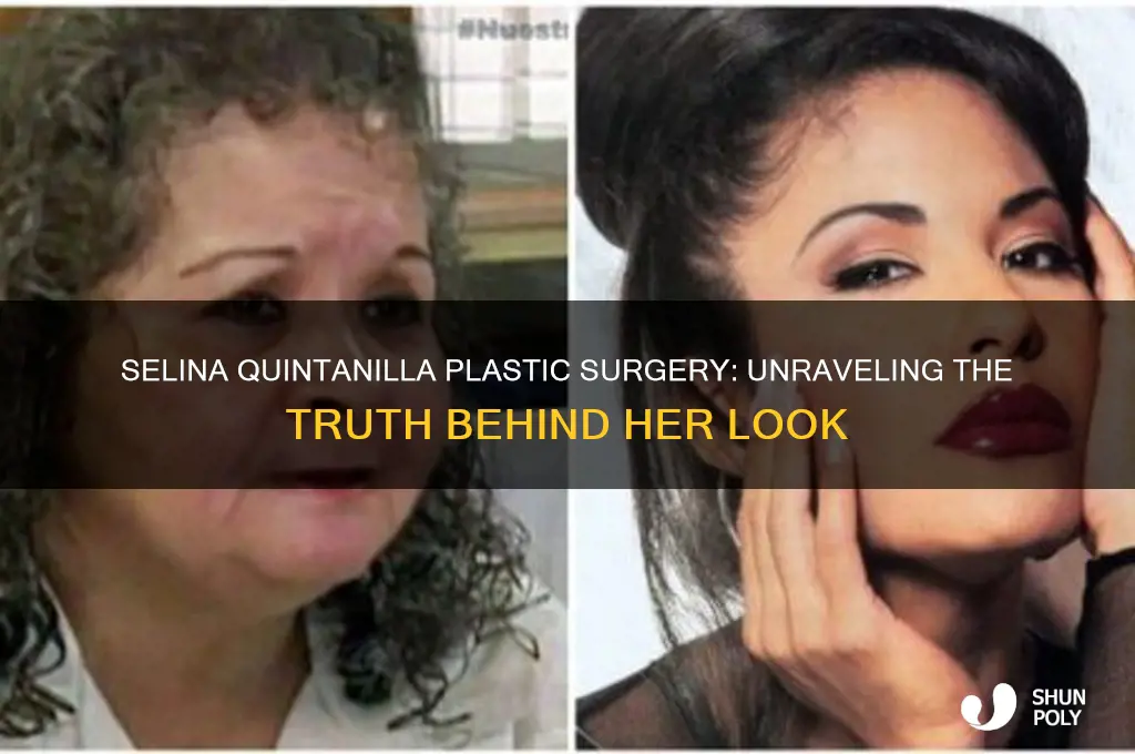 did selina quantanilla have plastic surgery
