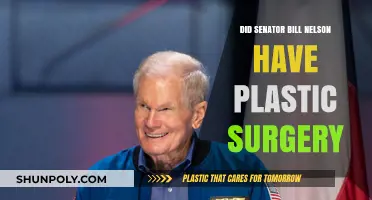 Senator Bill Nelson's Appearance: Plastic Surgery Speculations Explored