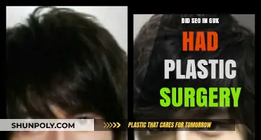 SEO In Guk Plastic Surgery: Fact or Fiction?