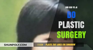 SEO YEJI PLASTIC SURGERY RUMORS: FACT OR FICTION?