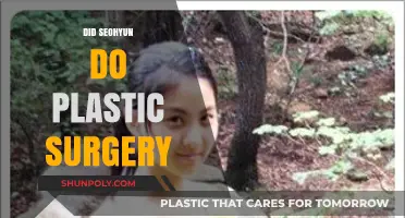Seohyun's Transformation: Plastic Surgery Rumors and the Truth Behind Them