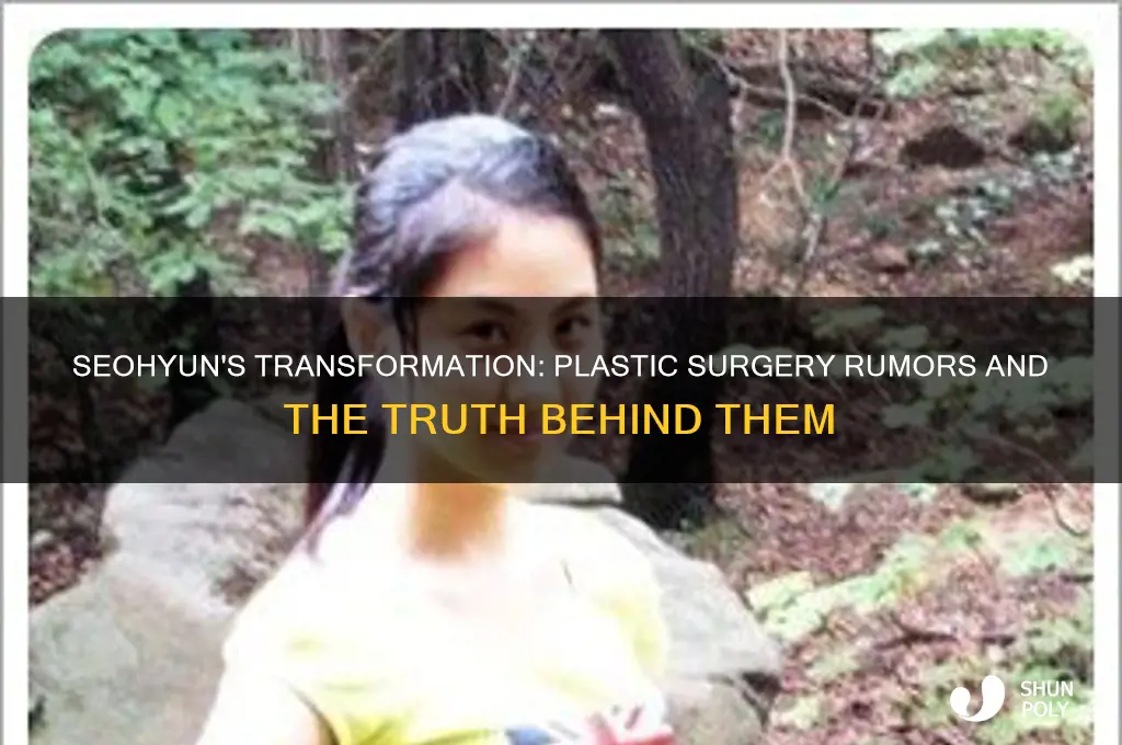 did seohyun do plastic surgery