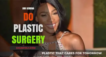 Serena Williams Plastic Surgery: Fact-Checking the Rumors and Speculations