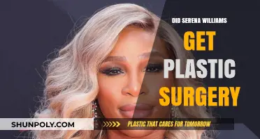 Serena Williams Plastic Surgery Rumors: Fact or Fiction?