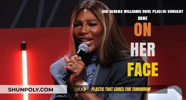 Serena Williams' Facial Transformation: Plastic Surgery Speculations Explored
