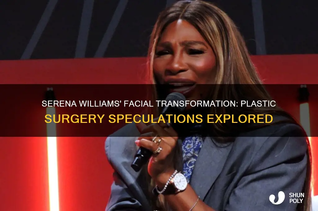 did serena williams have plastic surgery done on her face