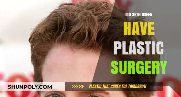 Seth Green's Transformation: Plastic Surgery Rumors Explored and Debunked