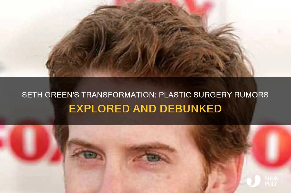 did seth green have plastic surgery