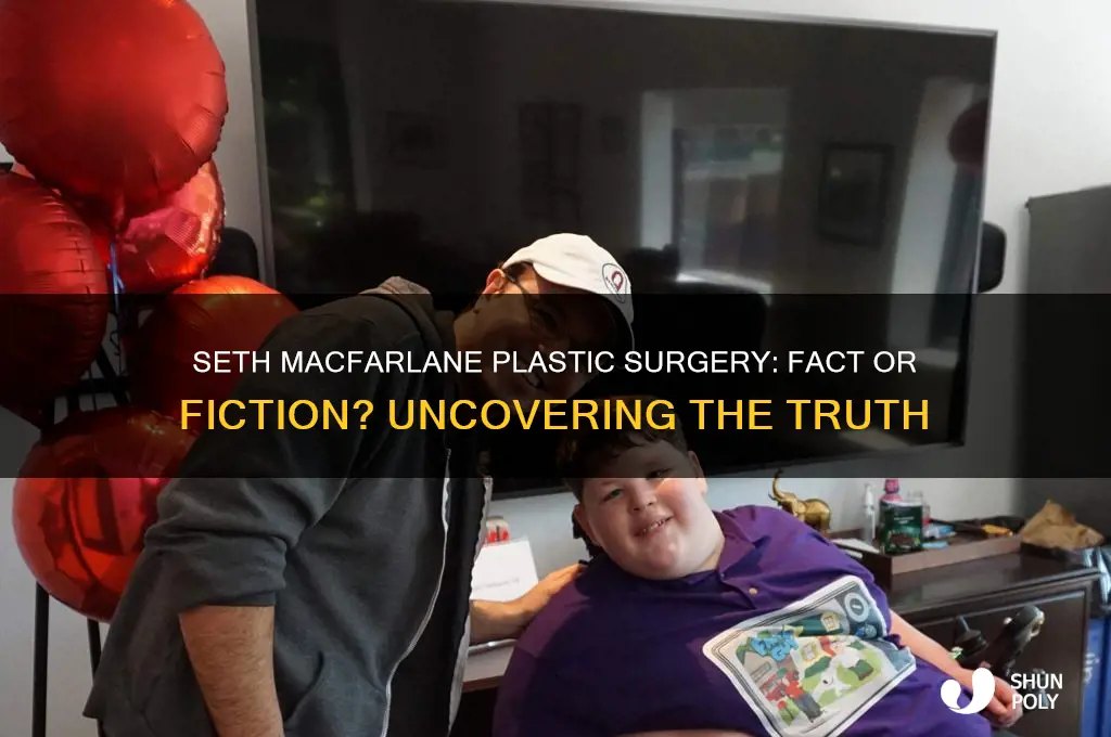 did seth macfarlane have plastic surgery