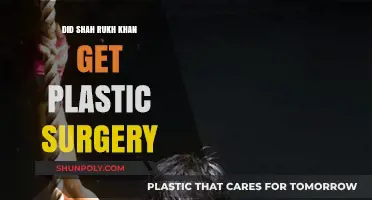 Shah Rukh Khan's Transformation: Plastic Surgery Rumors Explored
