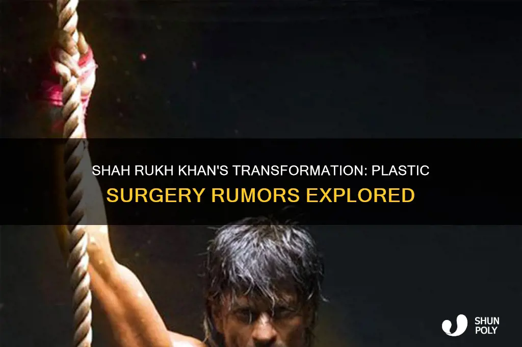 did shah rukh khan get plastic surgery