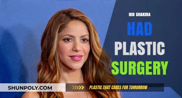 Shakira's Transformation: Plastic Surgery Rumors and the Truth Behind Them