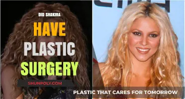 Shakira's Transformation: Unveiling the Truth About Plastic Surgery Rumors