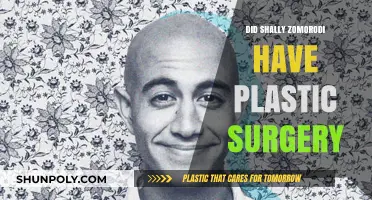 Shally Zomorodi's Transformation: Plastic Surgery Speculations Explored