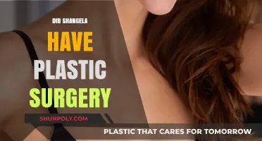 Shangela's Transformation: Unveiling the Truth About Plastic Surgery Speculations