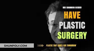 Shannon Beider's Transformation: Plastic Surgery Rumors Explored and Debunked