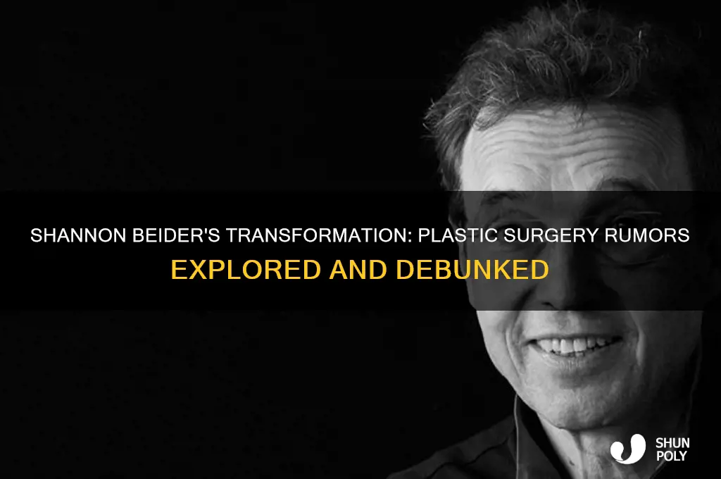 did shannon beider have plastic surgery