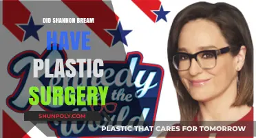 Shannon Bream Plastic Surgery: Fact-Checking the Rumors and Speculations