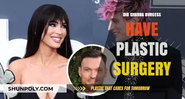 Sharna Burgess Plastic Surgery: Fact-Checking the Rumors and Speculations