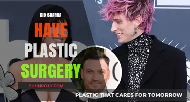 Sharna's Transformation: Plastic Surgery Speculations and the Truth Revealed