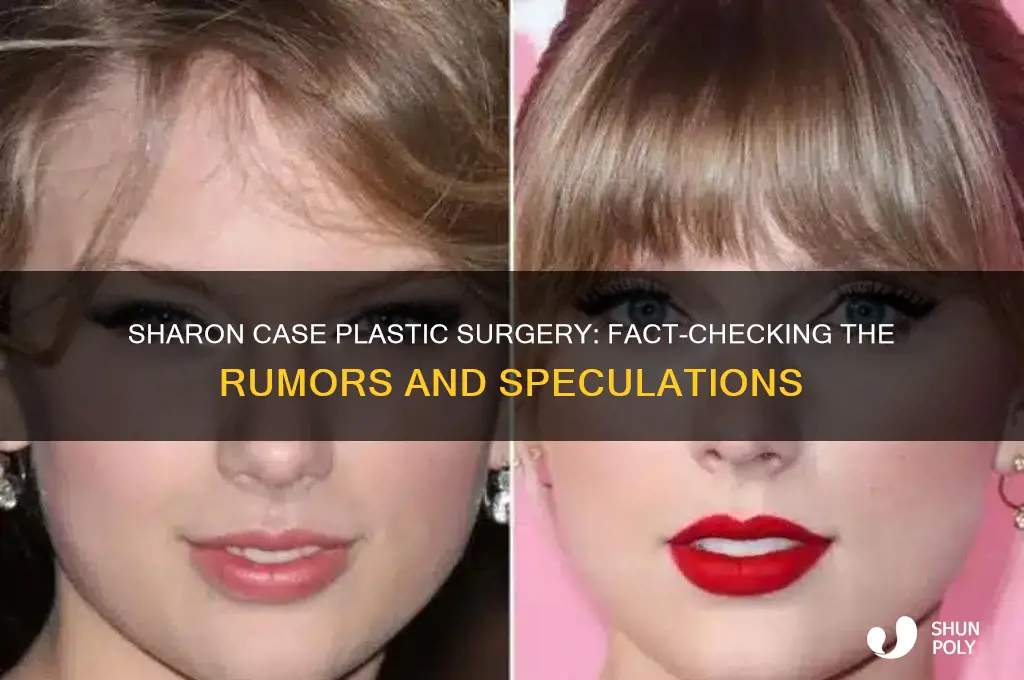 did sharon case get plastic surgery