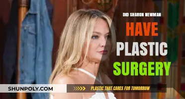 Sharon Newman's Transformation: Plastic Surgery Rumors Explored