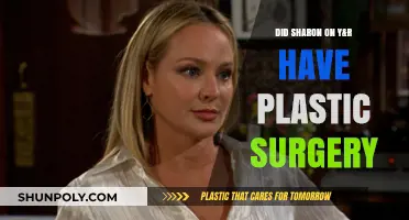 Sharon Newman's Transformation: Plastic Surgery Rumors on Y&R Explored