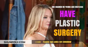 Sharon Newman's Transformation: Plastic Surgery Rumors on 'The Young and Restless