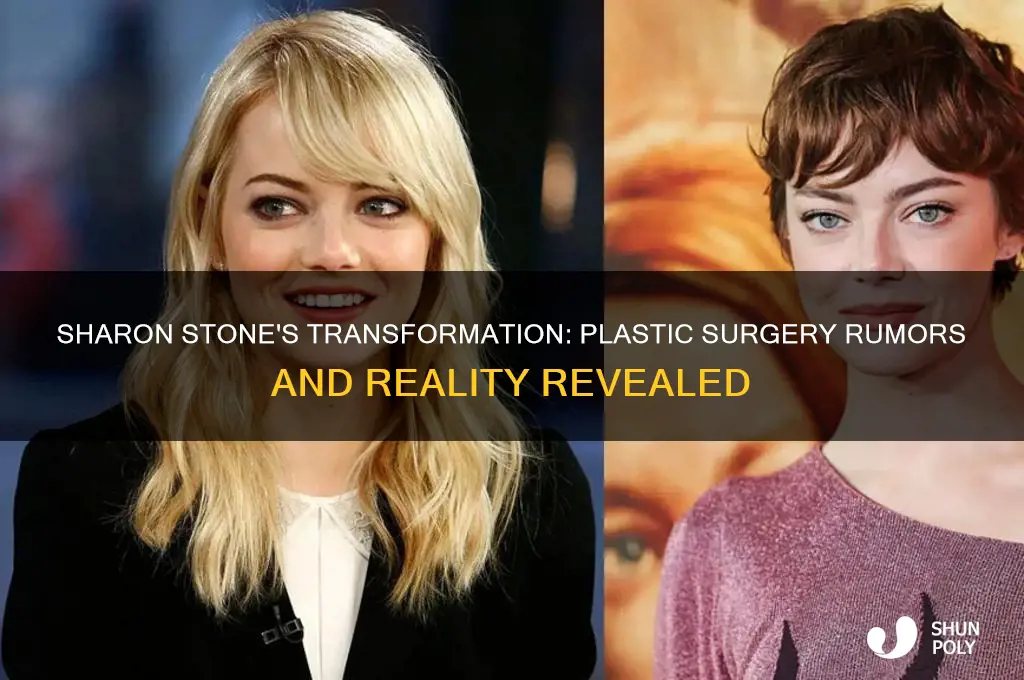 did sharon stone have plastic surgery