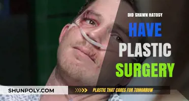 Shawn Hatosy's Transformation: Plastic Surgery Rumors Explored and Debunked