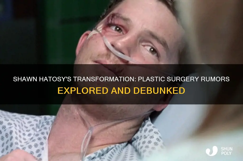 did shawn hatosy have plastic surgery