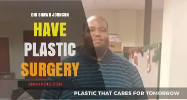 Shawn Johnson Plastic Surgery: Fact-Checking the Rumors and Speculations