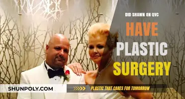 Shawn on QVC: Plastic Surgery Speculations and Transformation Truths